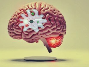 Modern Treatments for Epilepsy