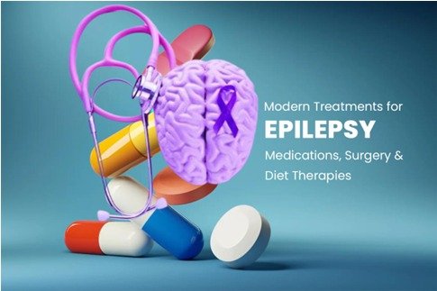 Modern Treatments for Epilepsy